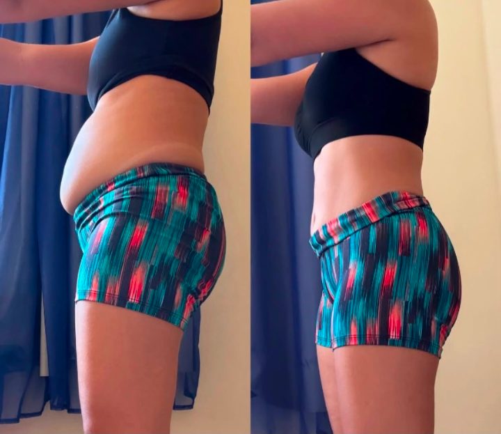Antes e depois de cliente 17