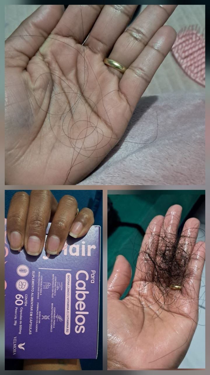 Comparativo de queda de cabelo com Hey Hair